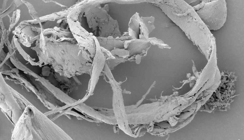 national institute of allergy and infectious diseases ti zxlh8g6s unsplash